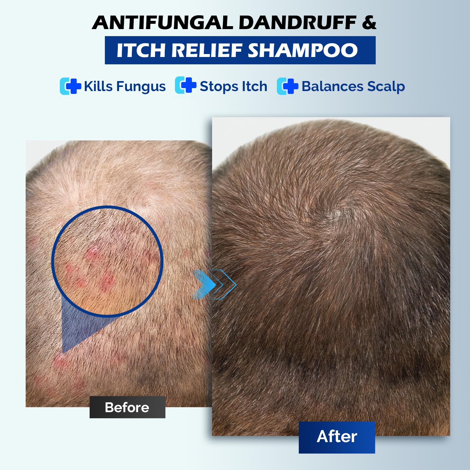 Formule douce Shampoing Oely adaptée à tous types de cheveux.