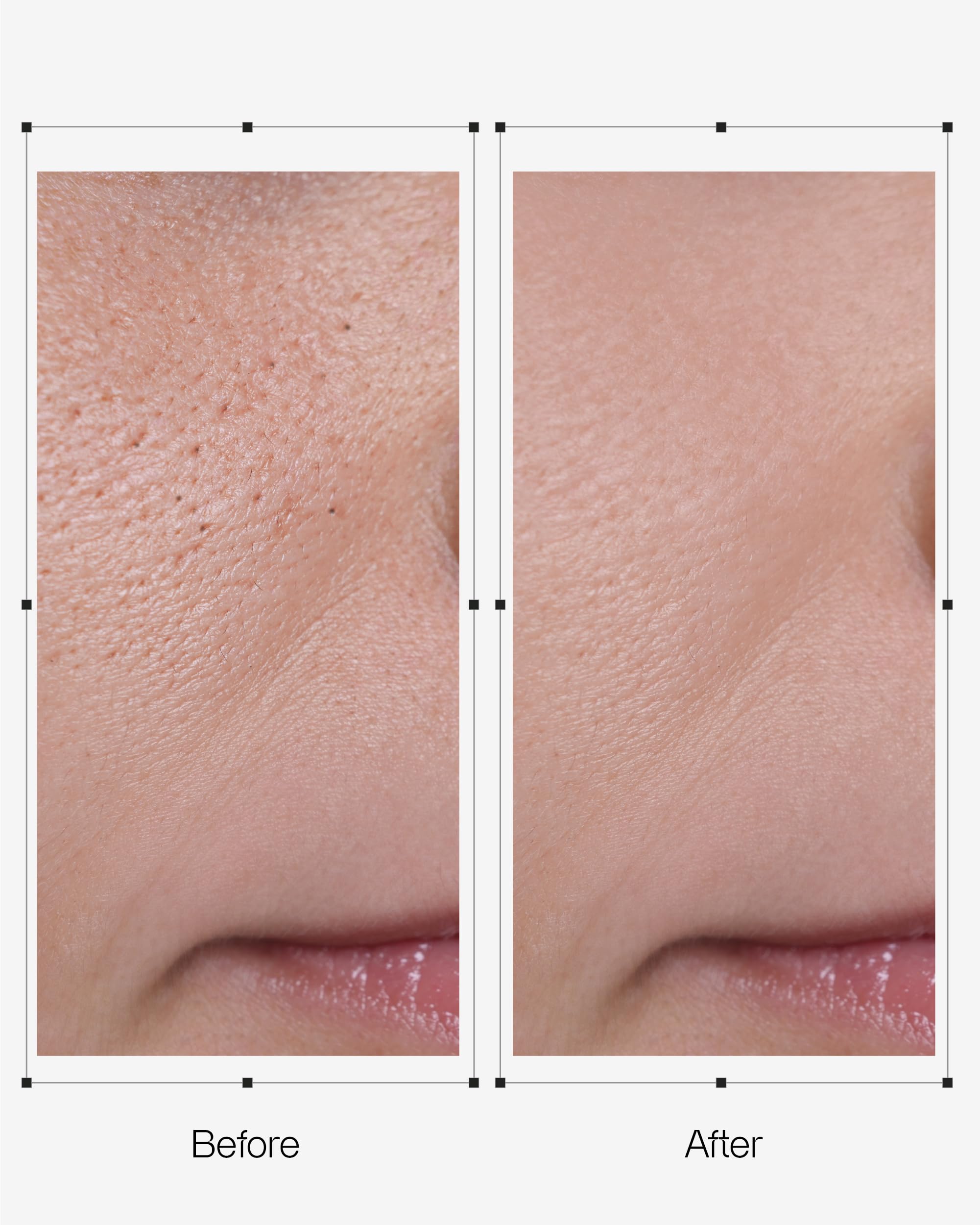 OGANACELL DERX Nettoyant – Mélange peptides et acides aminés pour l’élasticité.