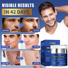 Olelon – Alpha Arbutine et Rétinol pour un teint uniforme.