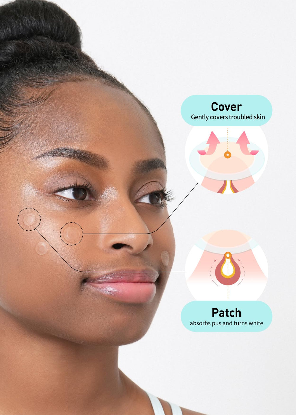 OLIVE YOUNG Care Plus hydrocolloid patch demonstrates waterproof adhesion during daily activities.