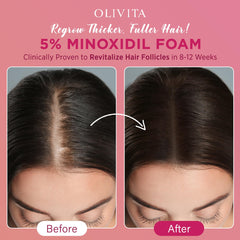 OLIVITA Minoxidil Foam – cuir chevelu nourri et apaisé après usage.