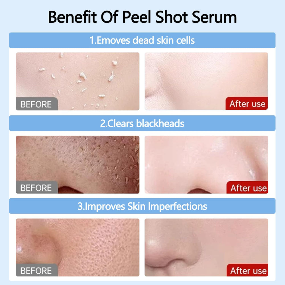 OLV Peel Shot Glow Riz Noir bouteille, pores resserrés et peau nette.