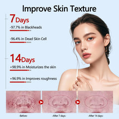 OLV Exfoliation liquide doux, texture légère adaptée à une utilisation quotidienne.