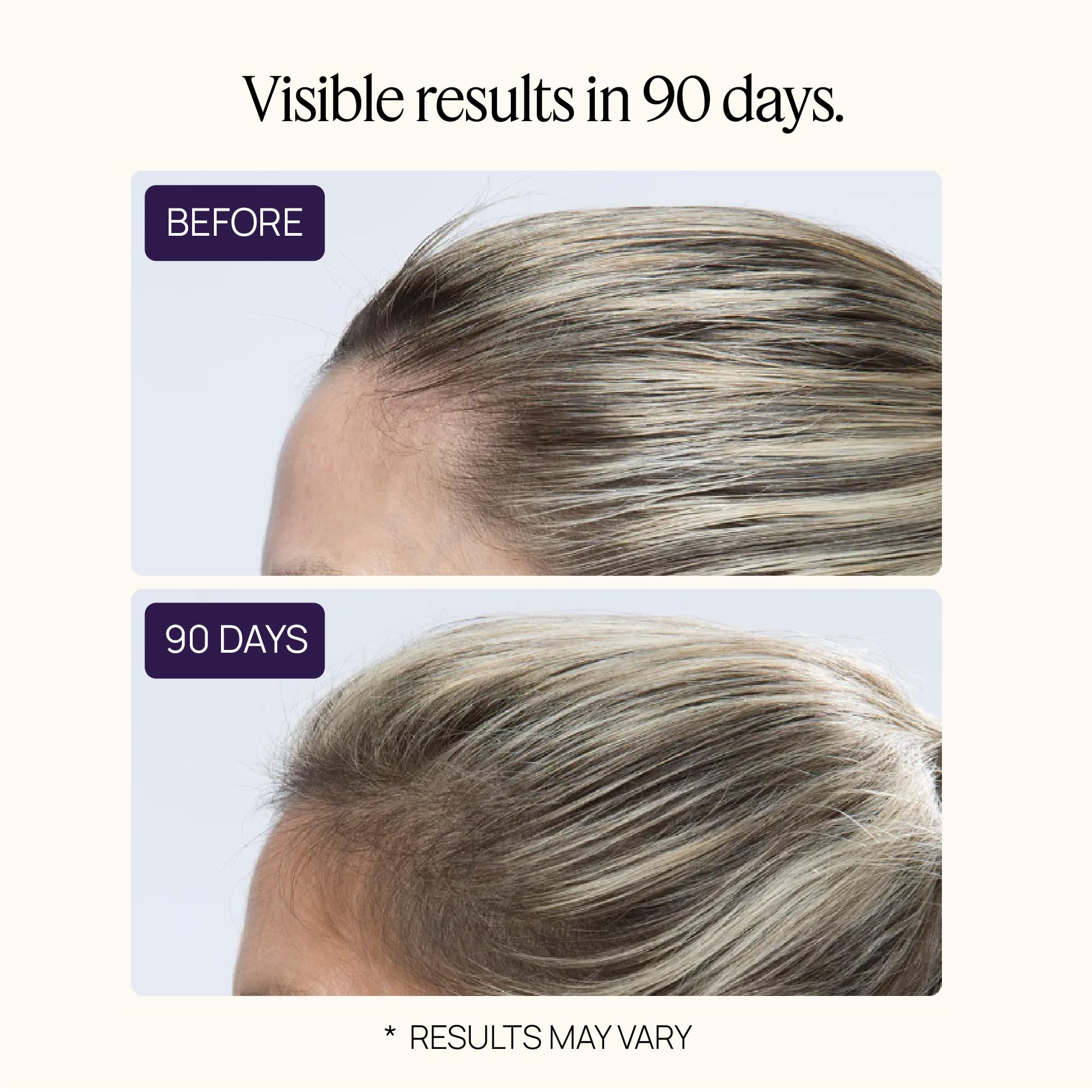 OMI WELLBEAUTY Recommandé par des médecins pour votre routine capillaire.
