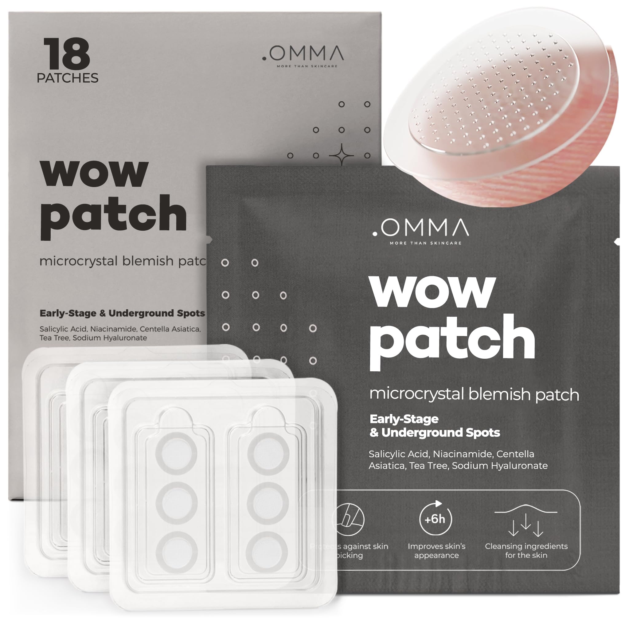 Pansement OMMA acné microdart 17 mm sur le visage, utilisation nocturne pour boutons profonds.