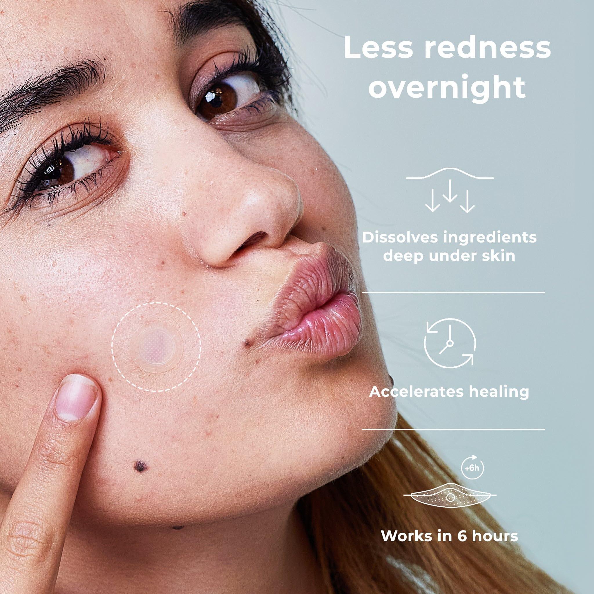 Pansement OMMA acné microdart, application ciblée nuit sur zones sensibles.