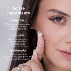 OMMA pansement avec acide salicylique pour traiter les points visibles discrètement.