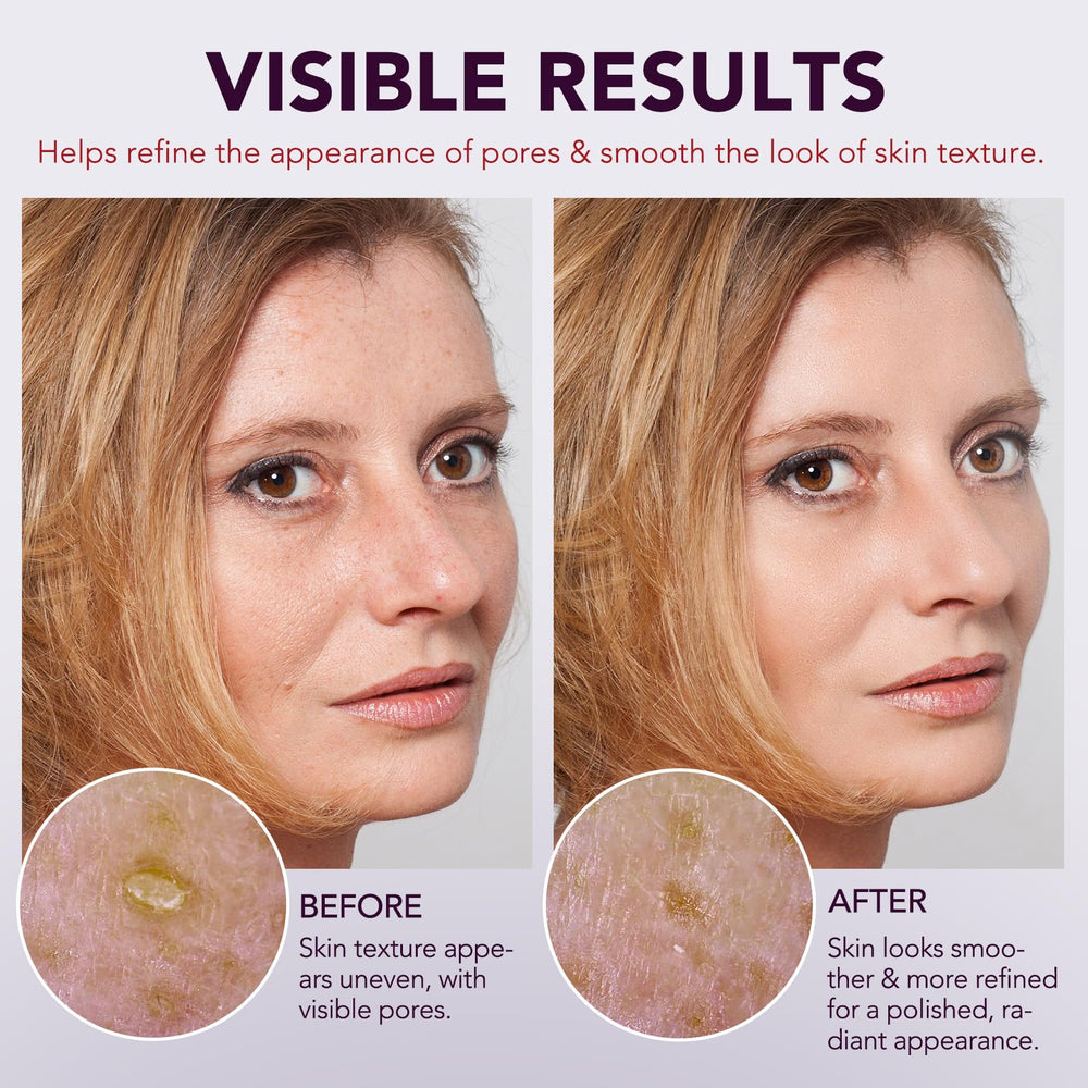 Ingrédients clés: niacinamide et hyaluronique pour hydratation et clarté.