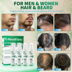 ONIADBA minoxidil spray being applied to the scalp for density support