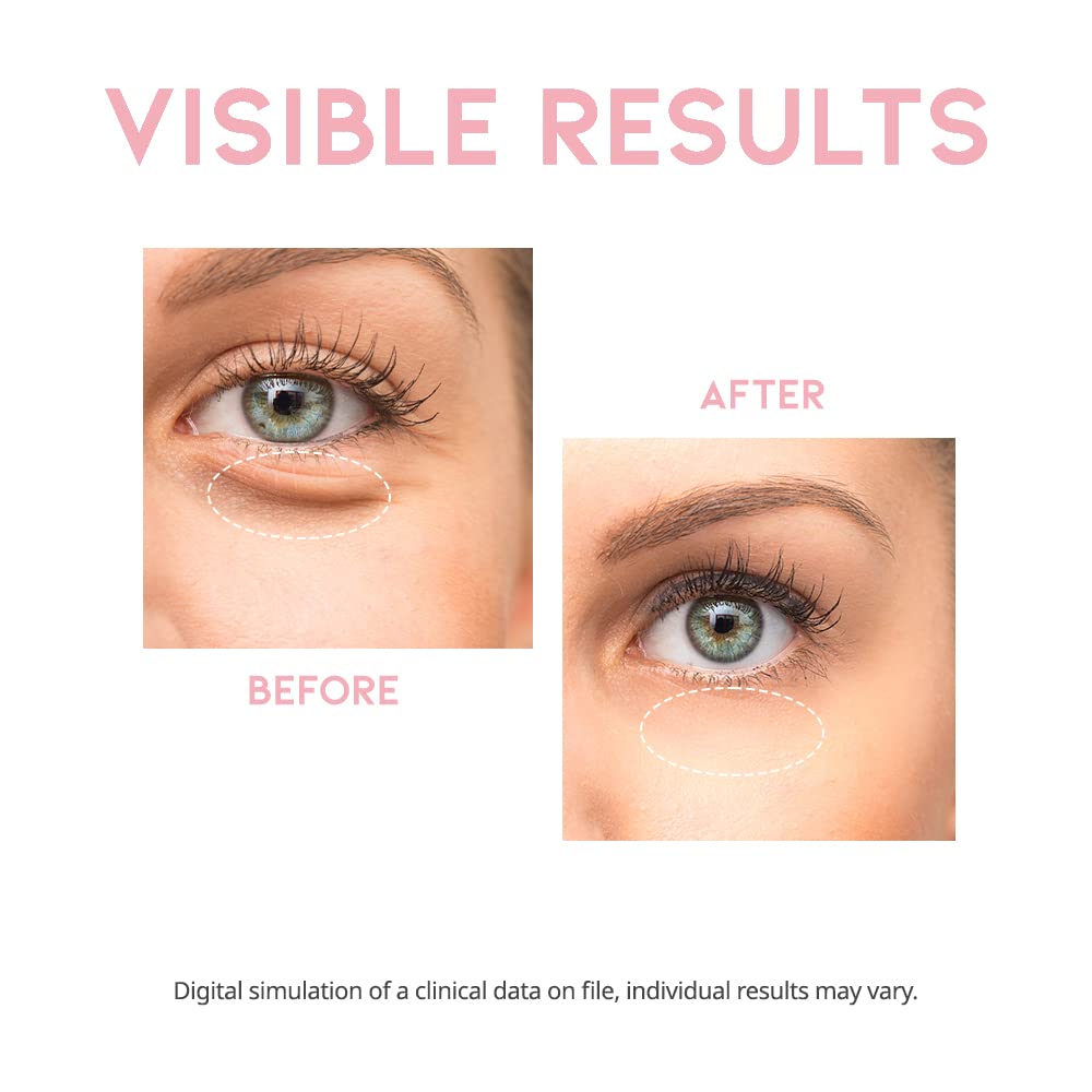 Utilisation quotidienne du sérum yeux #OOTD par hommes et femmes.