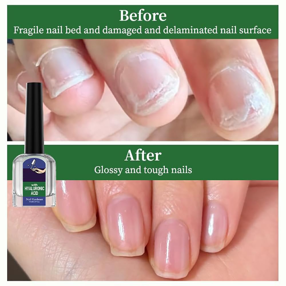 Oprtuisi huile cuticules usage quotidien pour cuticules hydratées et saines.