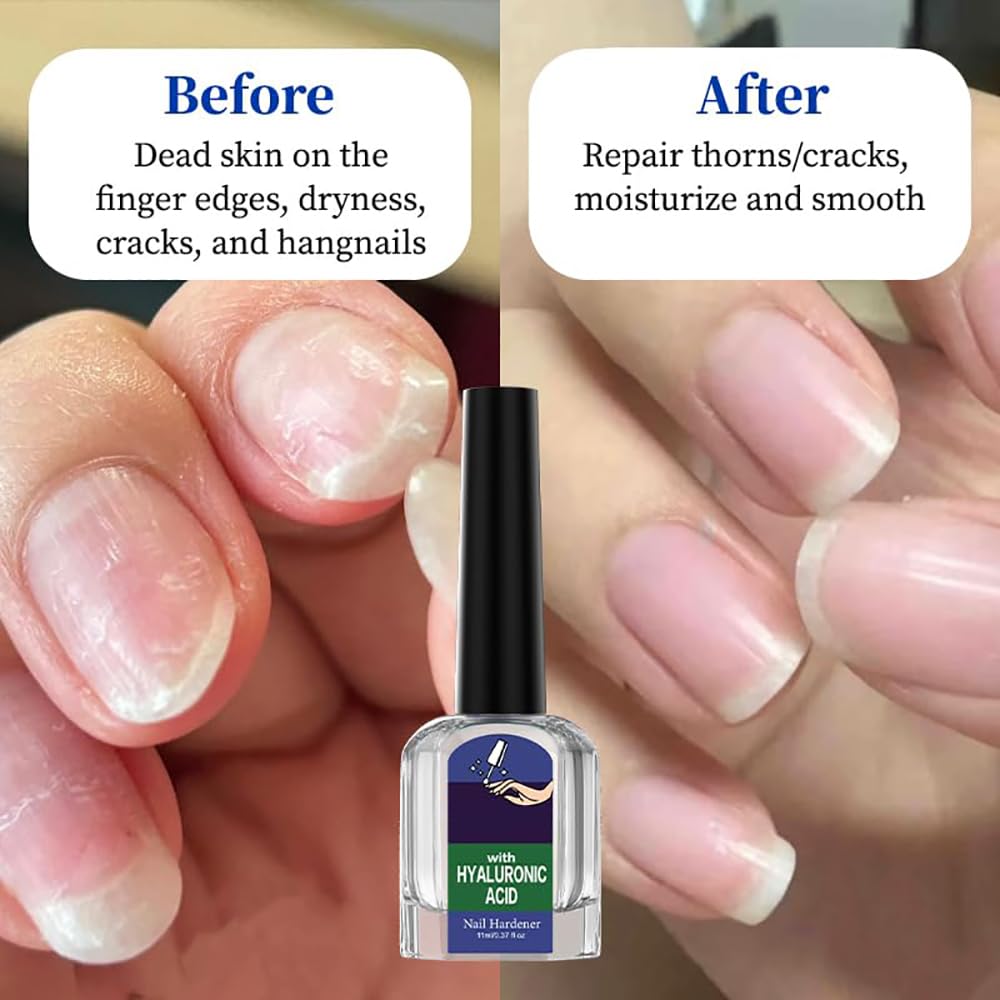 Oprtuisi serum cuticules réparation aide à réparer les cuticules craquelées.