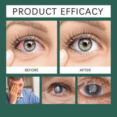 Optifusion Drops create a gentle protective moisture barrier for sensitive eyes.