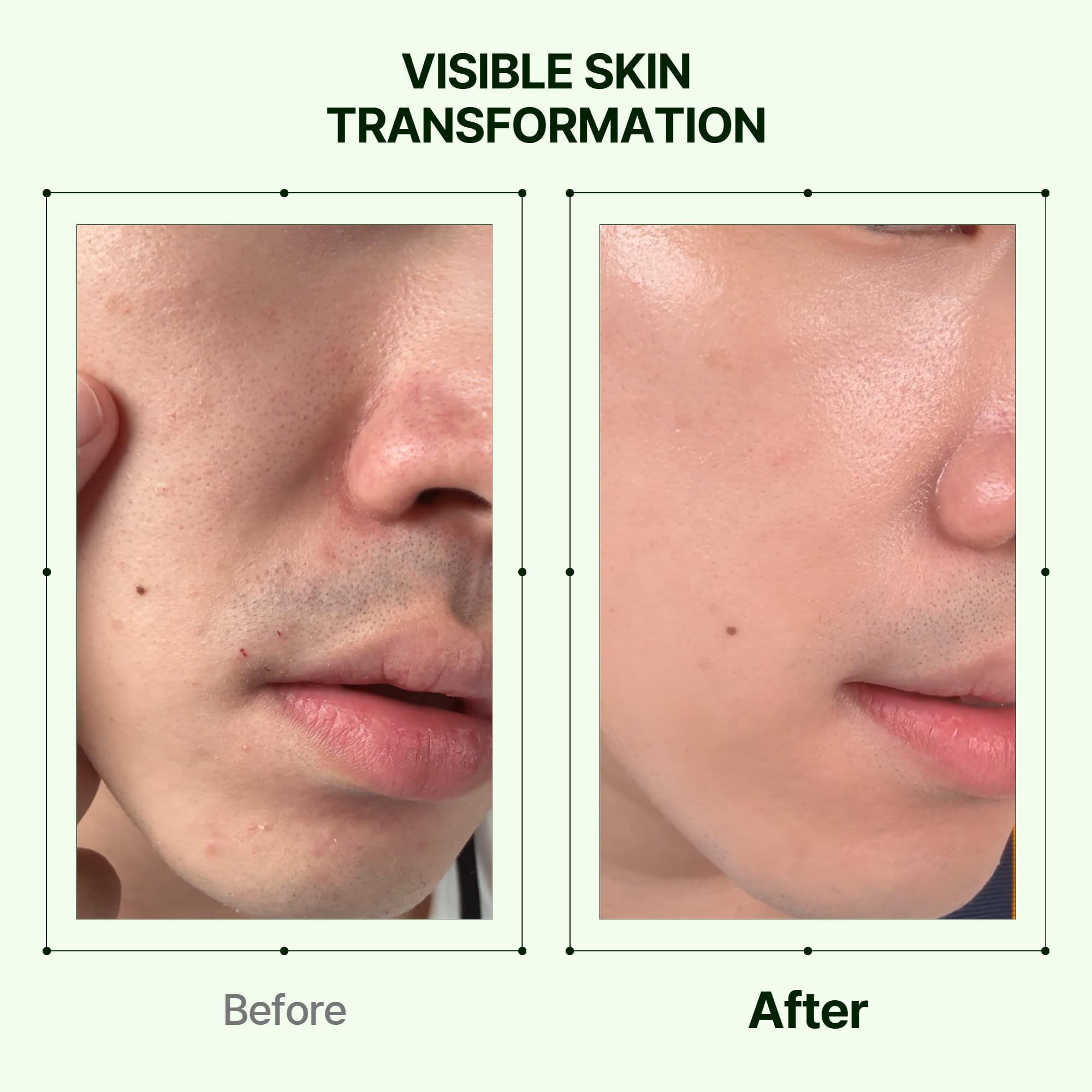 Orien Mugwort Pore Serum application matin et soir