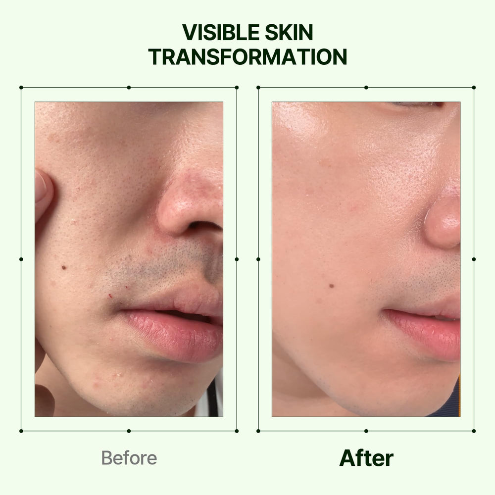 Orien Mugwort Pore Serum application matin et soir