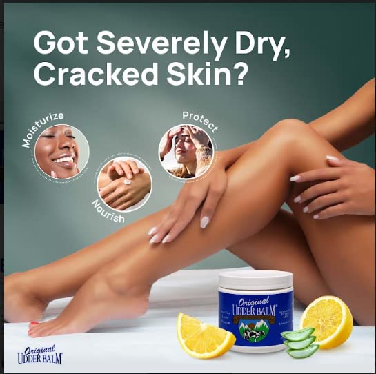 Original Udder Balm sur talons craqués, relief ciblé.