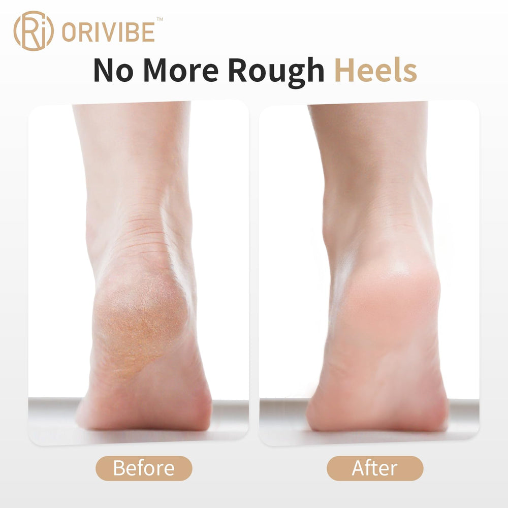 Orivibe: rouleaux fin et gros pour exfoliation efficace.