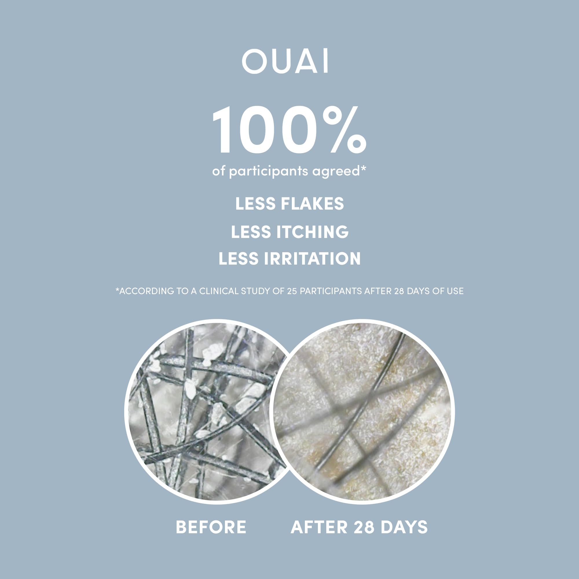 Utilisation ciblée de l’Anti-Pelliculaire pour les pellicules et l’irritation.