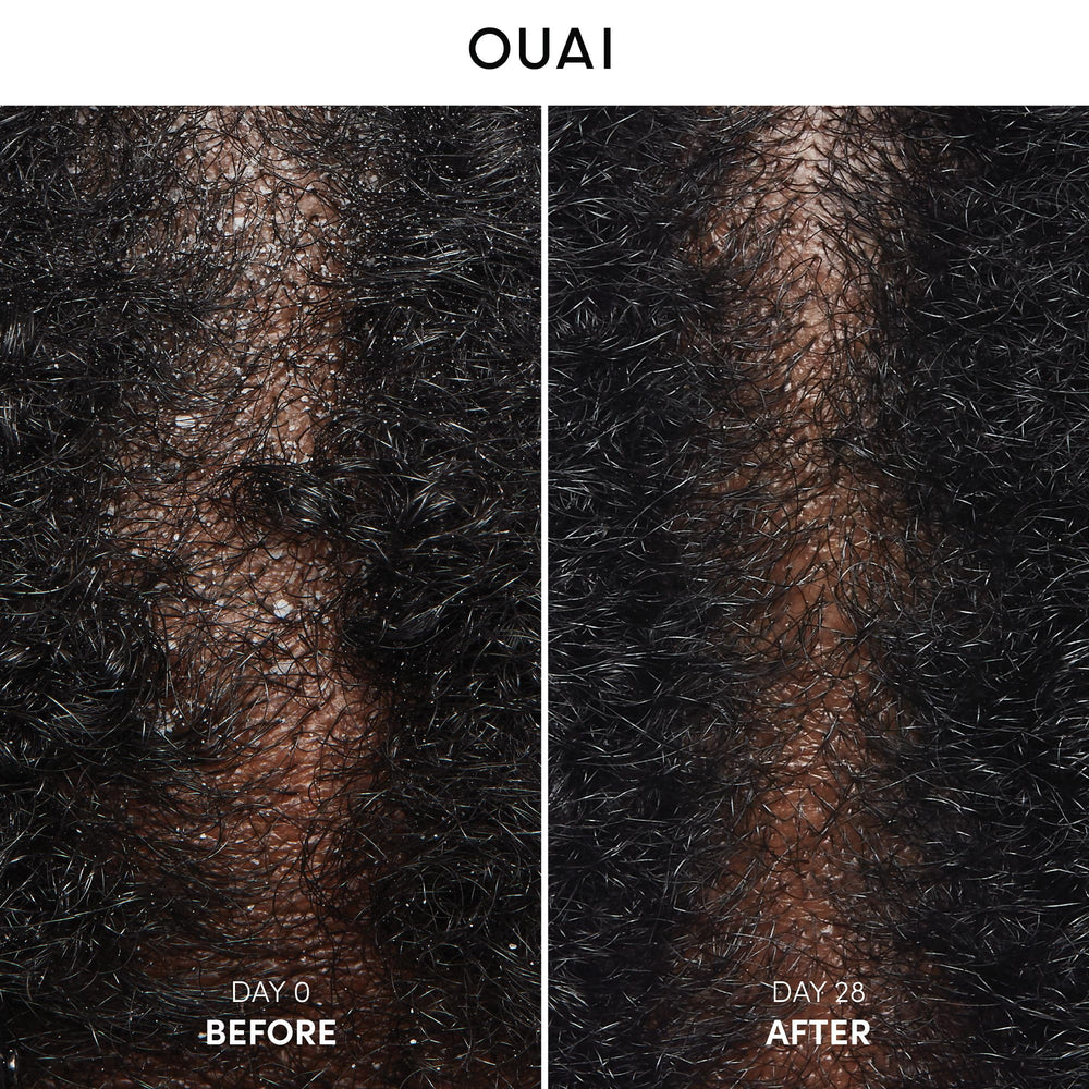OUAI shampooing antipelliculaire, mousse douce pour démêler et nettoyer le cuir chevelu.