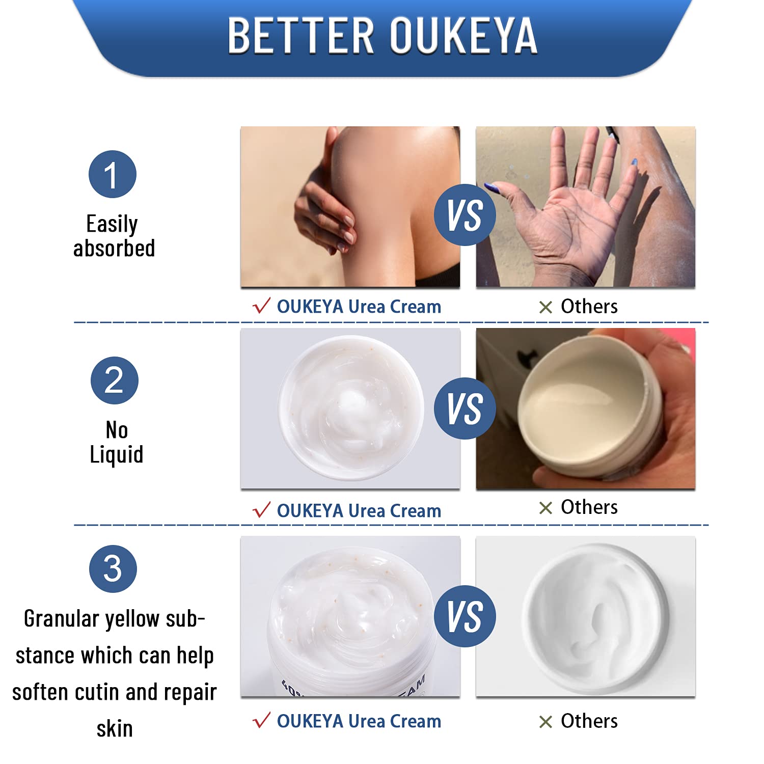 OUKEYA Crème urée 40% texture légère — absorption rapide.