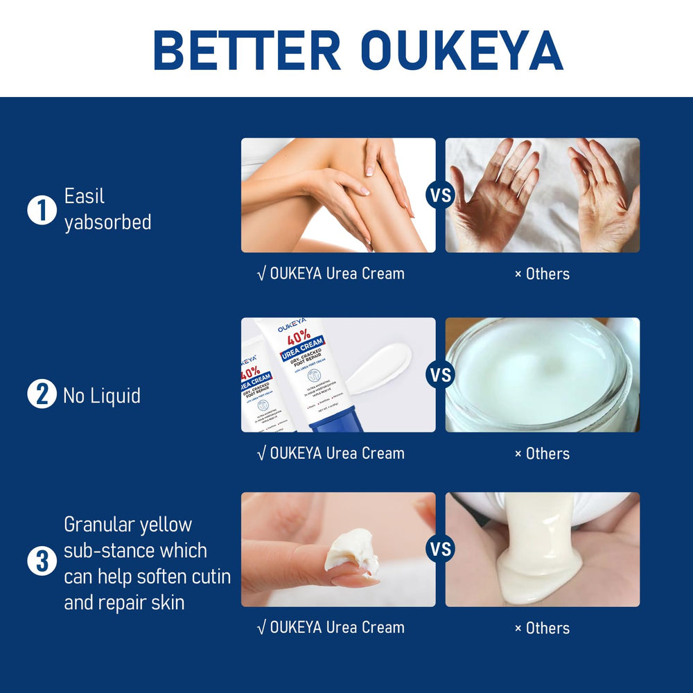 Pieds plus doux après OUKEYA Crème Urée 40%.
