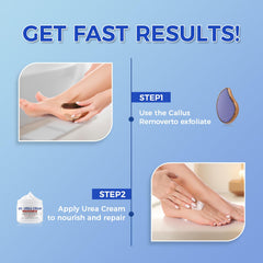 Application facile sur les pieds avec OUKEYA Urea 42%.