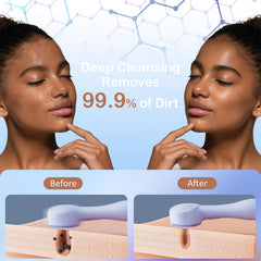 OUTIFUO brosse visage silicone bleue, exfoliation douce pour peaux sensibles