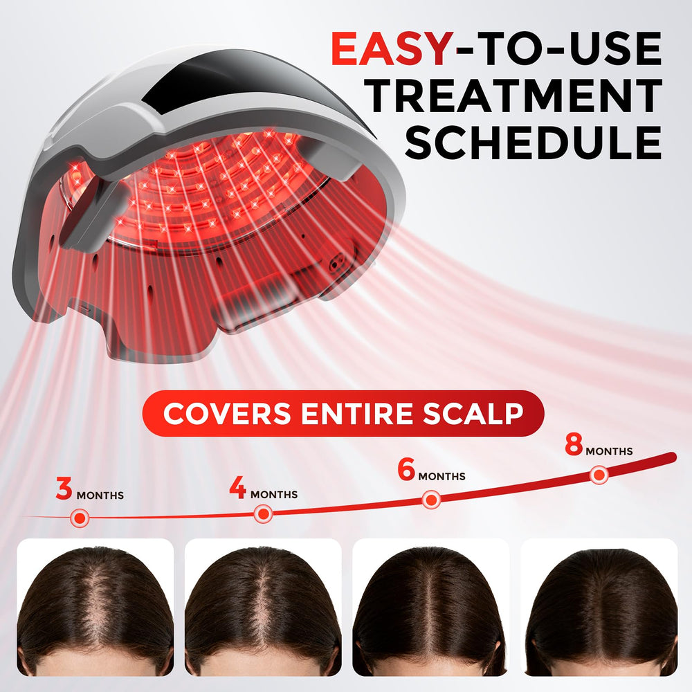 OVEKPA Laser Casque Cheveux: durée 25 minutes pour une routine pratique
