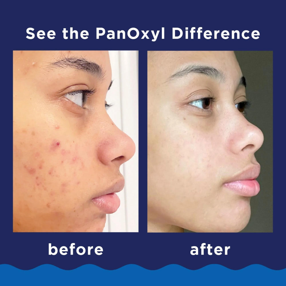 PanOxyl rituel visage quotidien, lavage moussant efficace