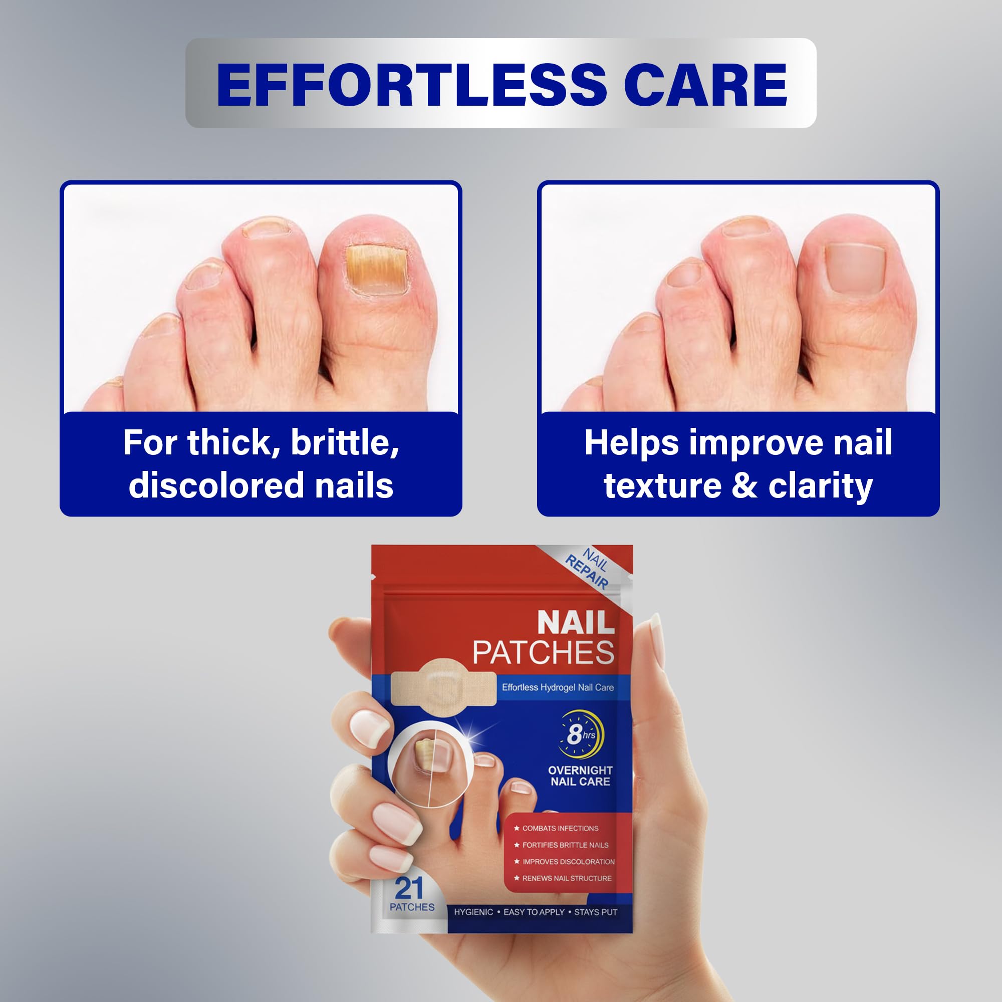 Patchs Ongles Fongiques: utilisation quotidienne simple et pratique