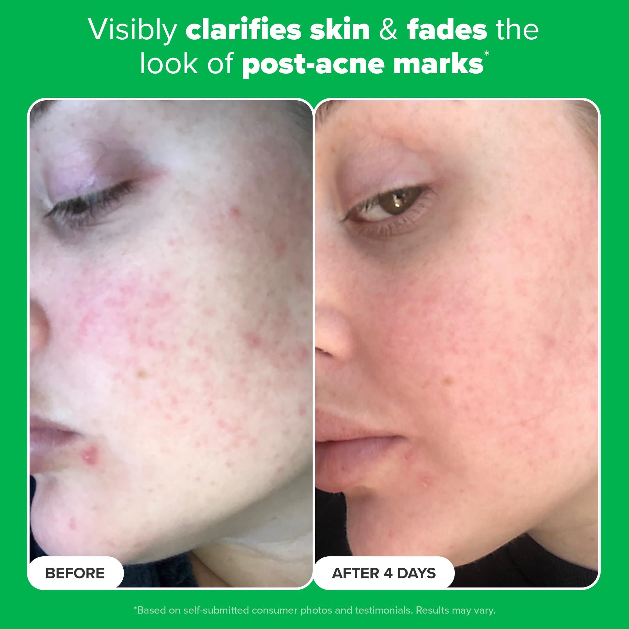 Paula's Choice Boost gel texture close-up, light and non-greasy.