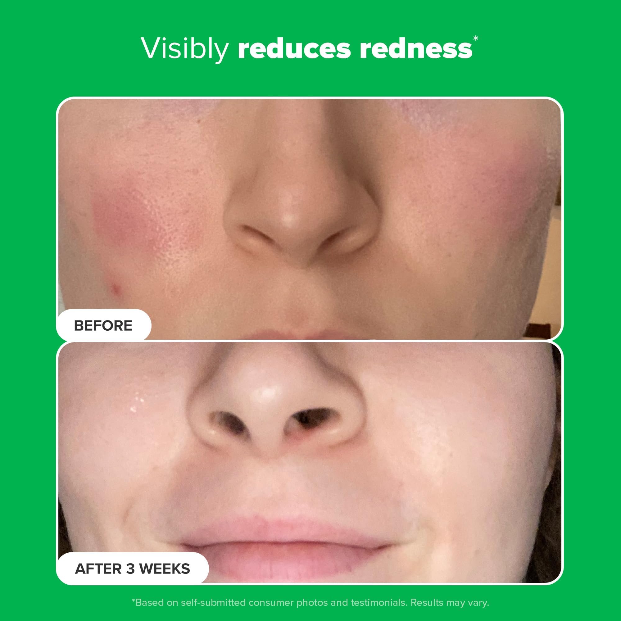 Paula's Choice – pores dégagés pour peau nette