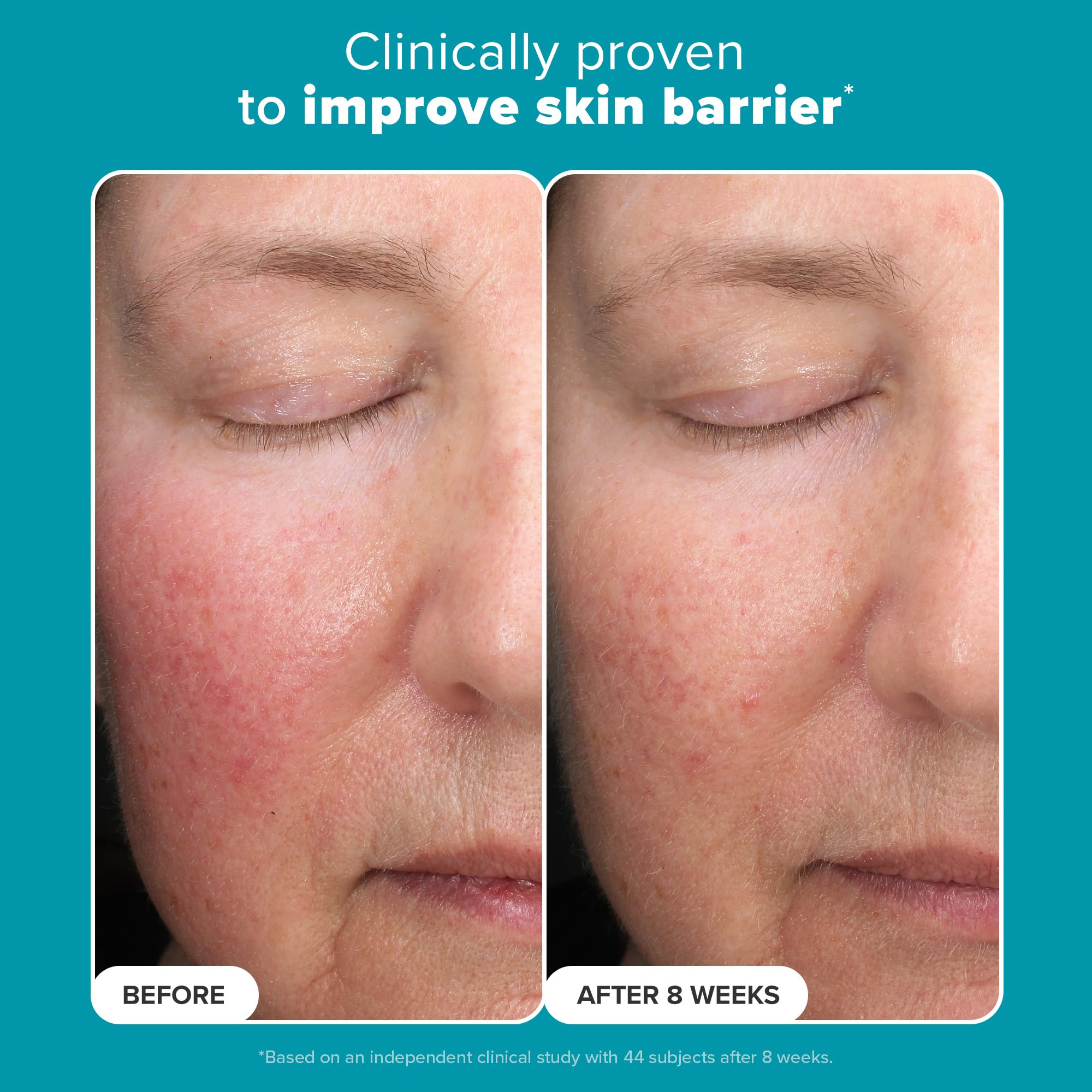 Exfoliant Paula's Choice – barrière cutanée renforcée et protection contre les agressions.