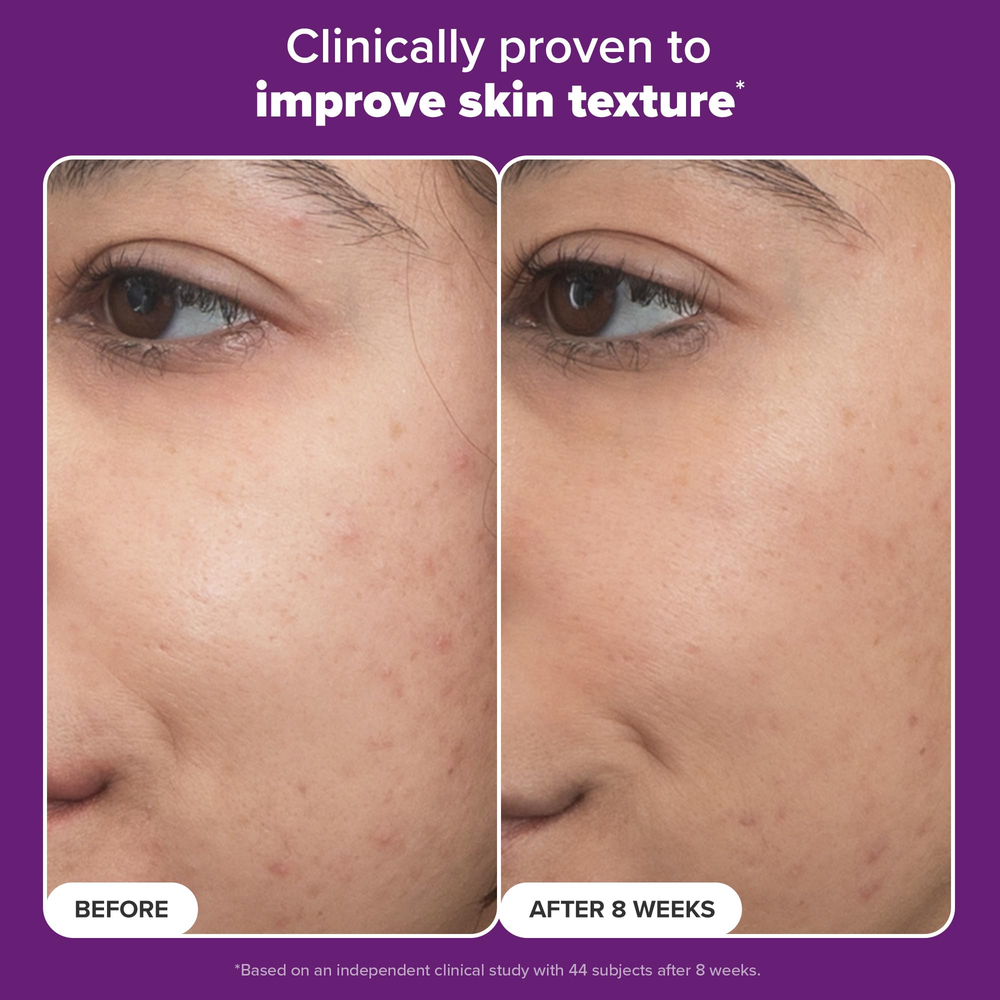 Utilisation matin et soir de Paula's Choice Pro‑Rétinaldéhyde dans votre routine.