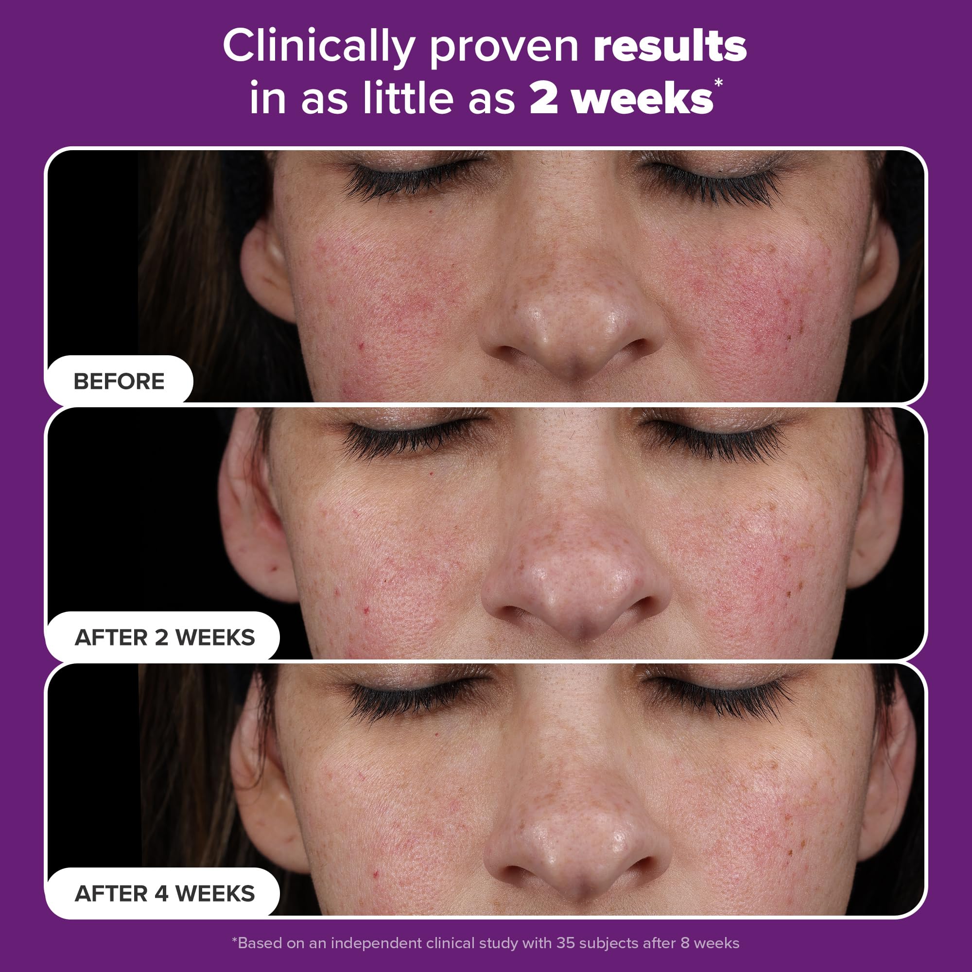 Sérum Paula's Choice Pro‑Rétinaldéhyde : éclat et teint unifié après utilisation.