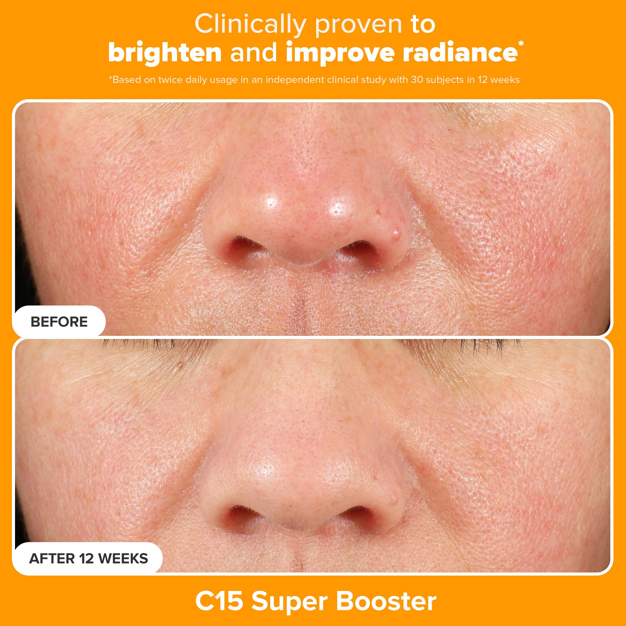 Sérum C15 Booster – flacon qui illumine et unifie le teint.