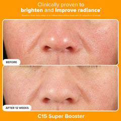 Sérum C15 Booster – flacon qui illumine et unifie le teint.