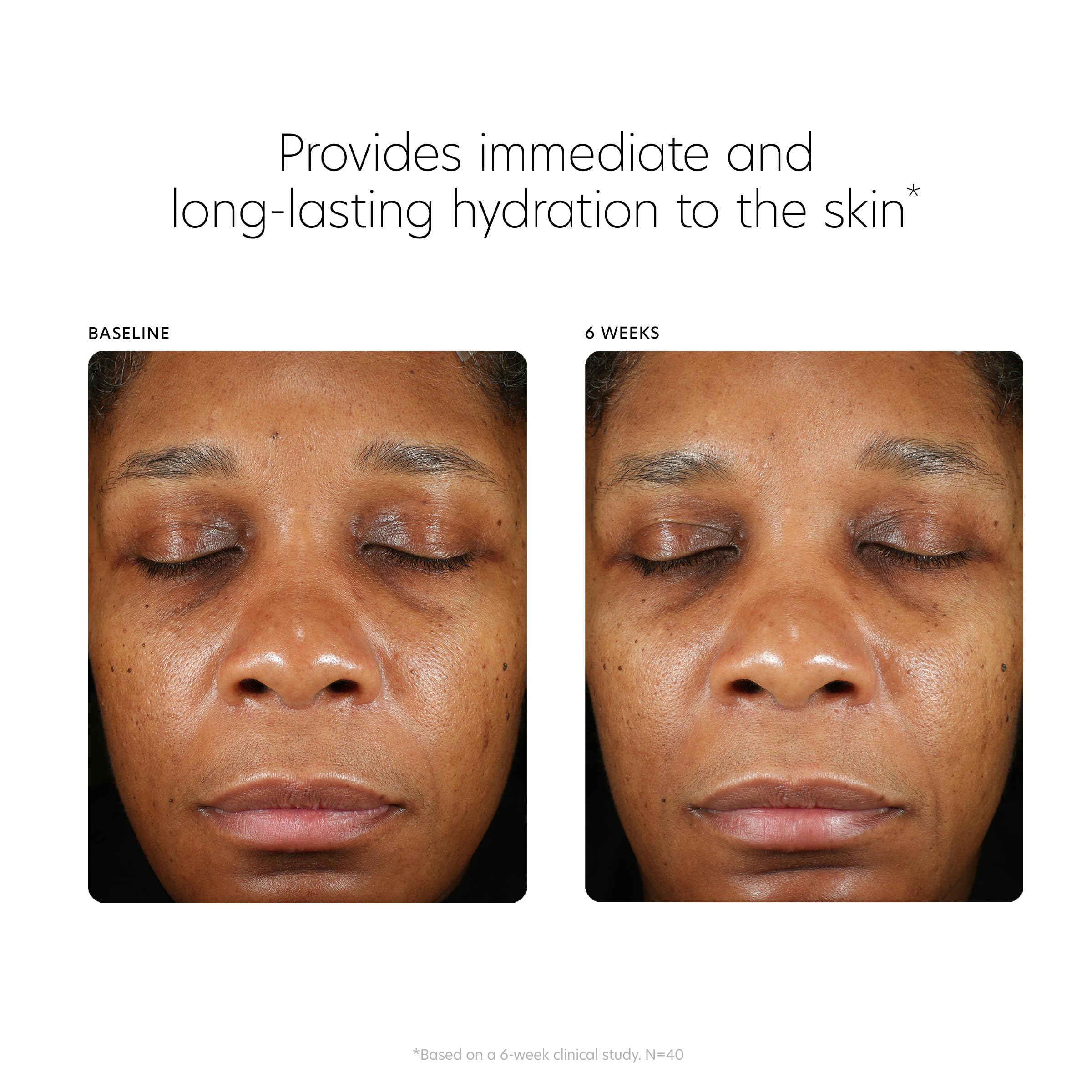 PCA SKIN HA-Pro Complex hydratation longue durée