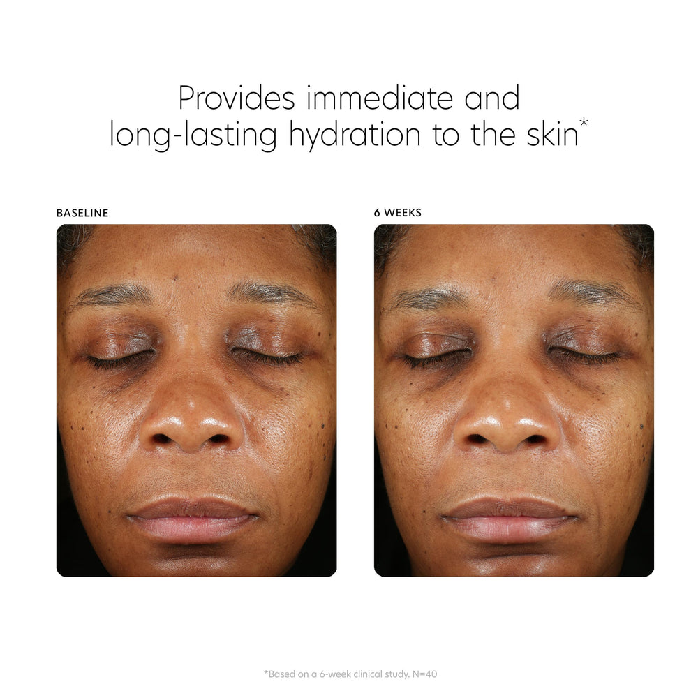 PCA SKIN HA-Pro Complex hydratation longue durée