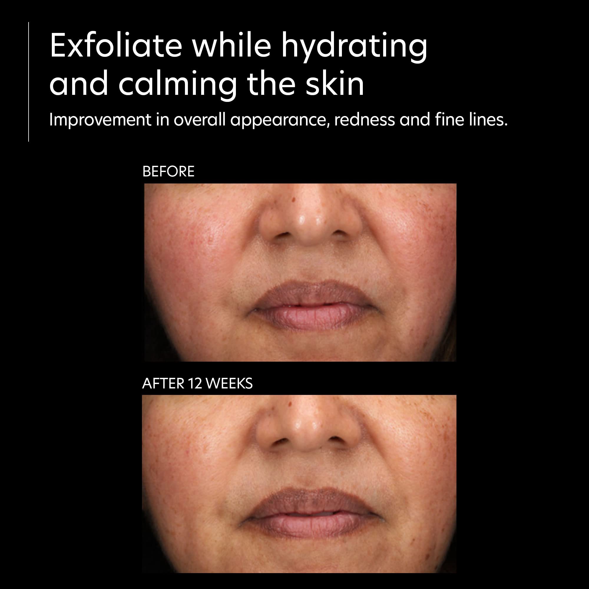Application quotidienne sur visage et cou pour une peau hydratée et soignée.