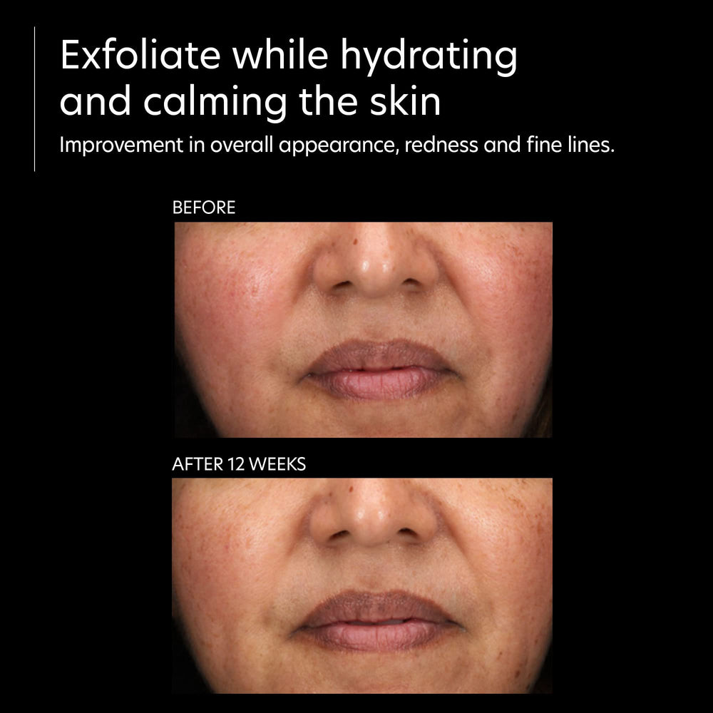 Application quotidienne sur visage et cou pour une peau hydratée et soignée.