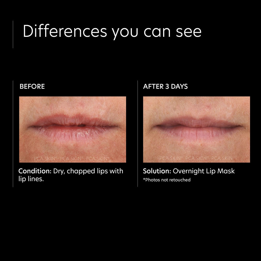 PCA SKIN – squalane huile naturelle, émollient soutenant l’hydratation.