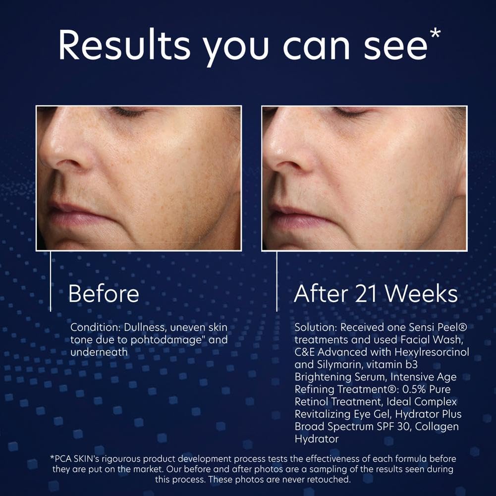 PCA SKIN Sérum Éclaircissant à la Vitamine B3, teint uniforme et lumineux sur le long terme.