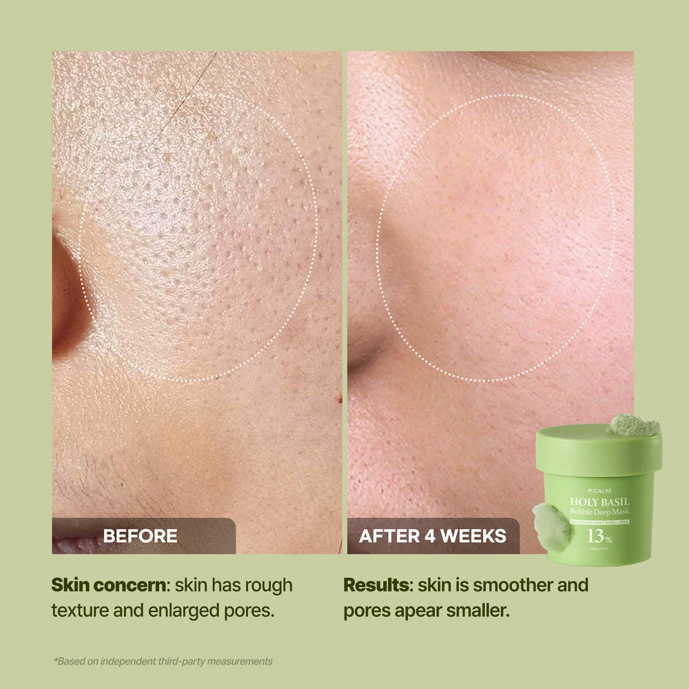 pcalm-reduction-sebum-bulles : Bulles aidant à réduire le sébum et lisser la peau.