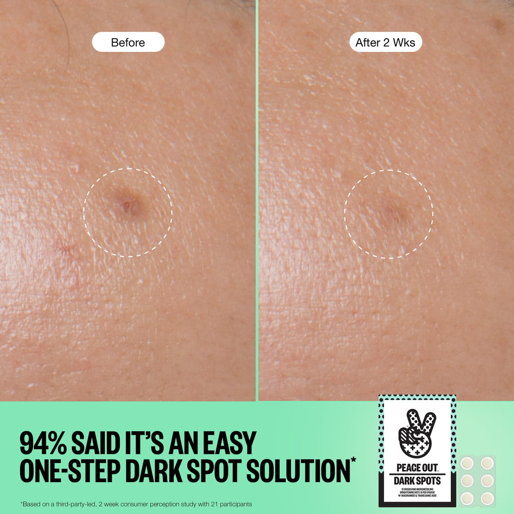 PEACE OUT Dots acide férulique protection antioxydante pour le visage.