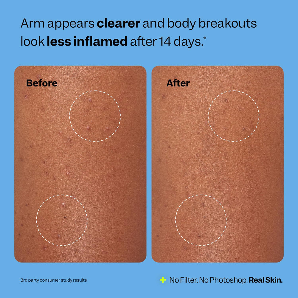 Patch Peach Slices hypoallergénique sans parfum ni alcool, respectueux de la peau.