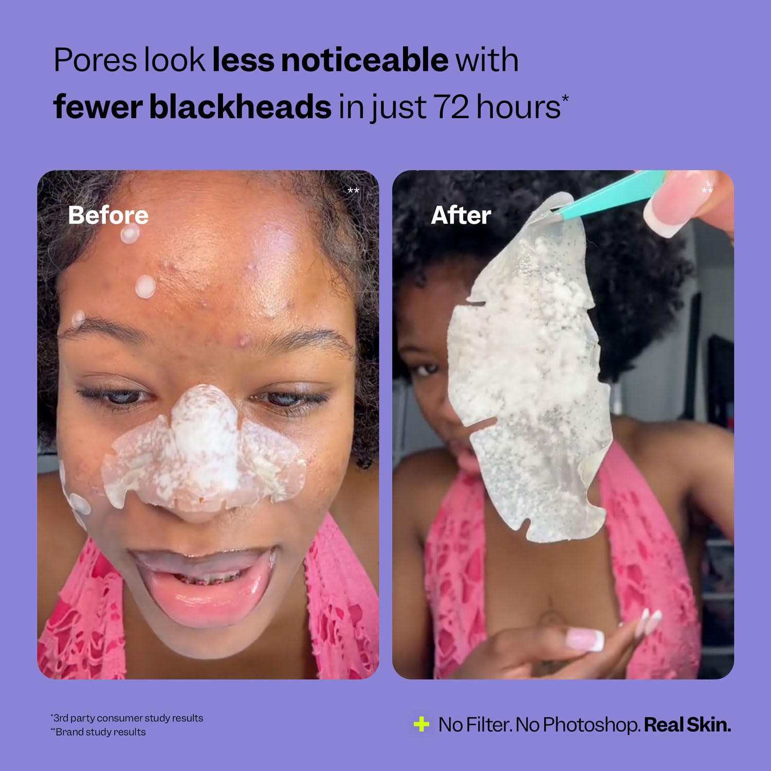 Patch pore du nez Peach Slices sans douleur lors du retrait.