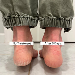 Pedestrian Project texture creme onctueuse — application facile pour pieds soignés rapidement.