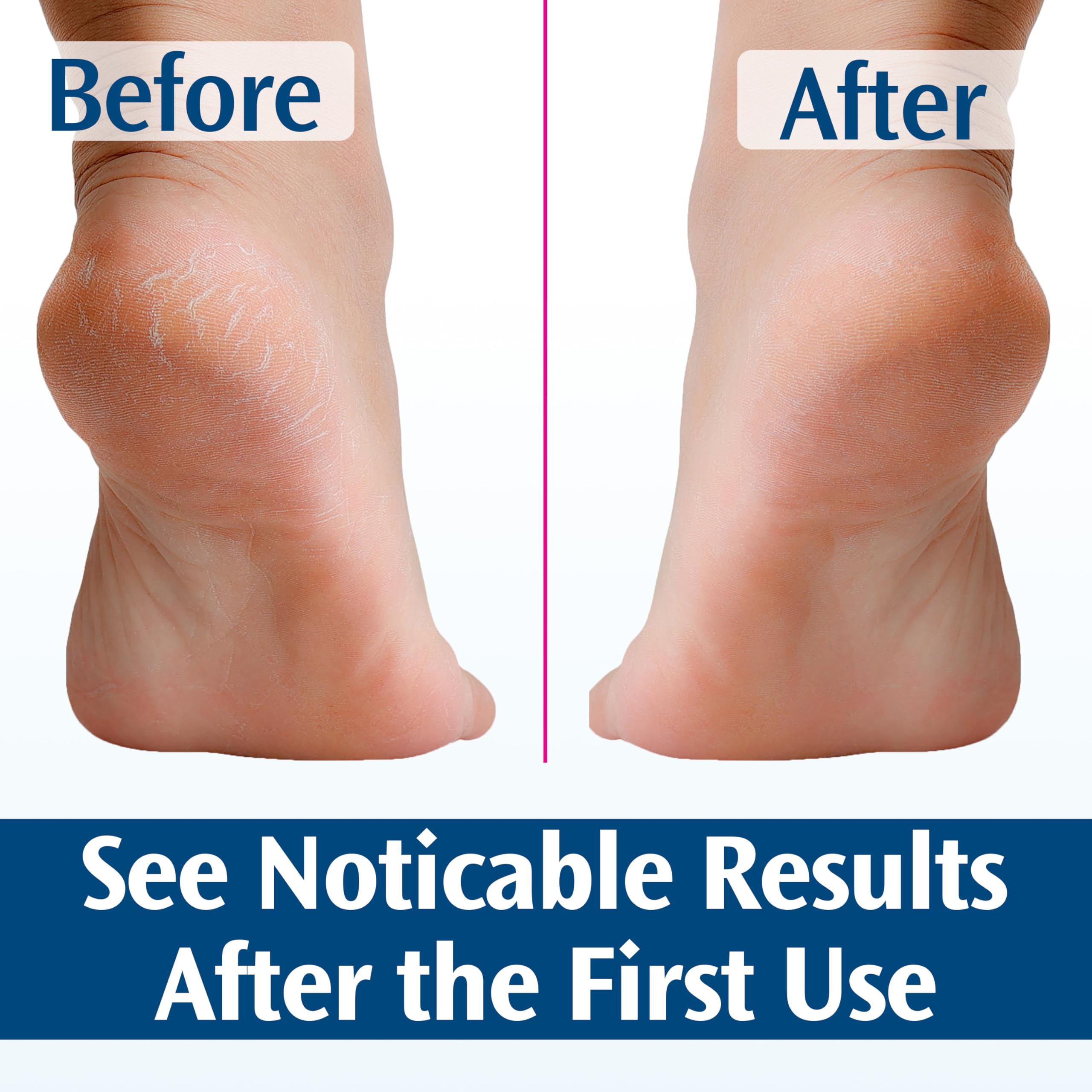 Pedifix Crème Pieds, adoucit callosités, peau plus lisse