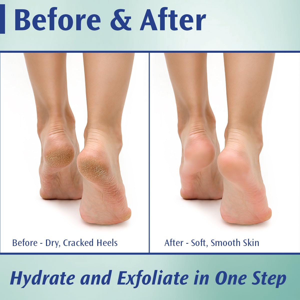 Pedifix Crème Pieds Utilisation Quotidienne pour pieds hydratés et doux.
